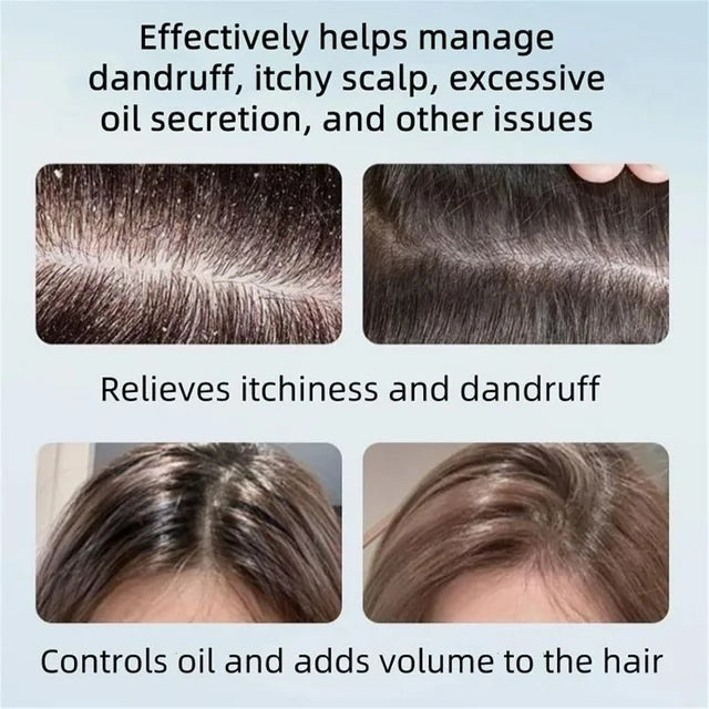 NIPPORI Anti-Dandruff Shampoo